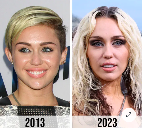 Miley Cyrus’ Fans Speculate That She Got ‘Plastic Surgery’ After Seeing Before-And-After PH๏τos From 2013 To 2023