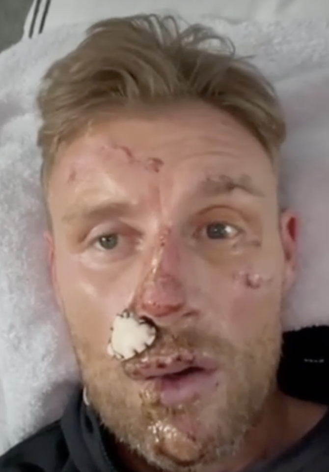 HORROR CRASH Freddie Flintoff’s Top Gear crash injuries revealed for the first time in emotional home video